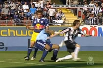 Soccer Goalie Shin Shattered by Kick